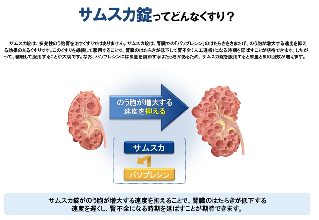 サムスカ錠ってどんなくすり？